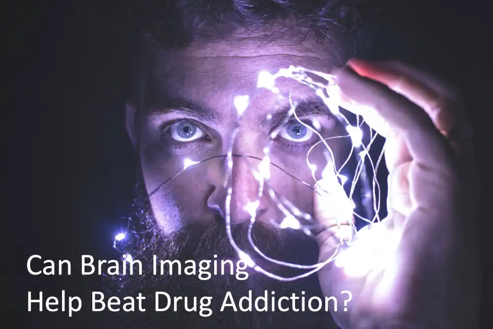 Can Brain Imaging Help Beat Drug Addiction?