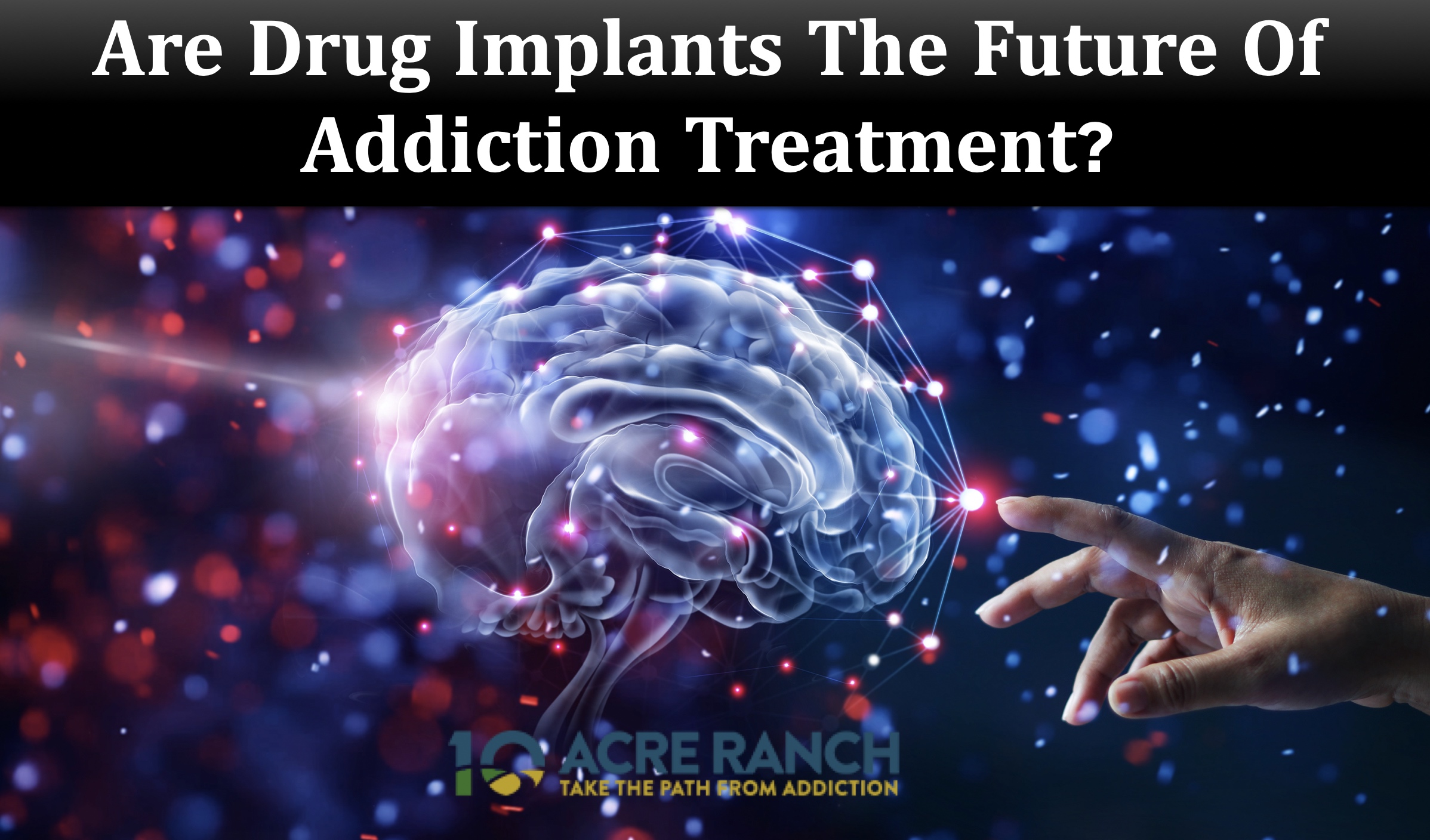 drug-implants-buprenorphine-naxtrexone-addiction-treatment-future-study-medical-science-Riverside-California